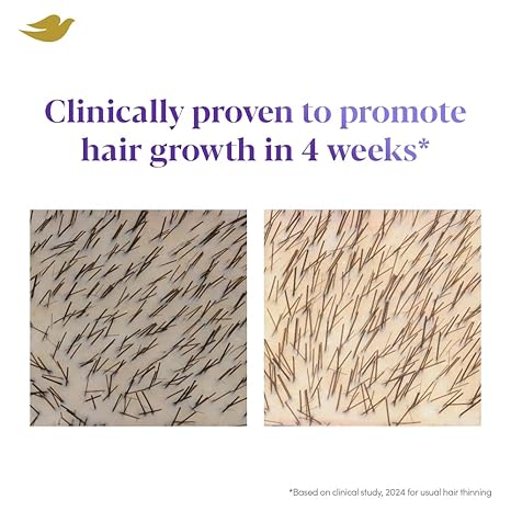 Dove Scalp + Hair Therapy Density Boost Revitalizing Scalp Serum with active ingredients 2.5% Niacinamide and 1.5% Zinc-peptides for visibly denser hair growth - Image 5